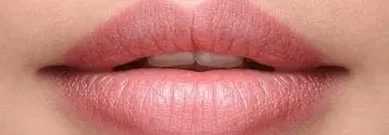 Lip augmentation